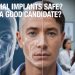 Are Facial Implants Safe? Who Is a Good Candidate?