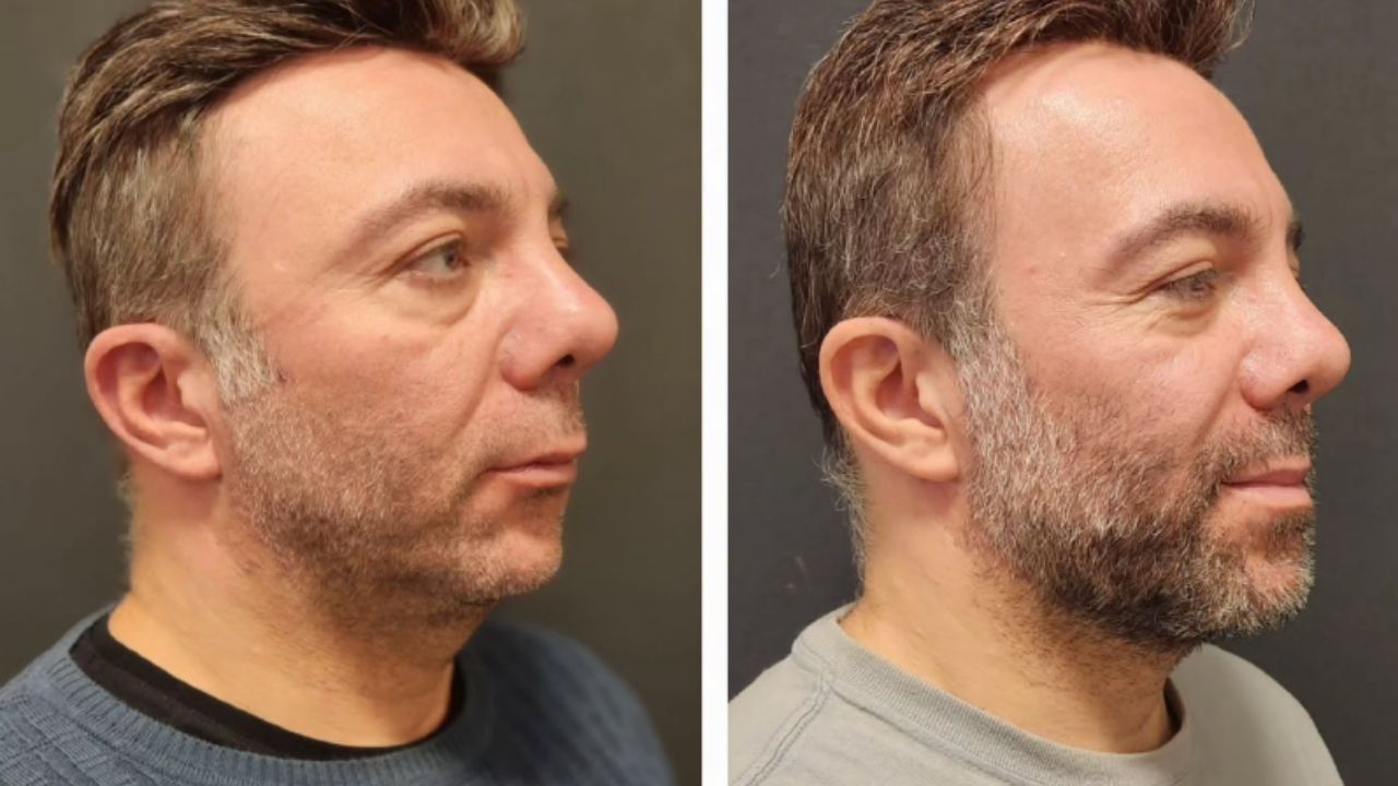 How Is TMJ Disorder Diagnosed?