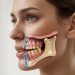 TMJ Ankylosis Surgery for Restoring Jaw Function and Facial Balance