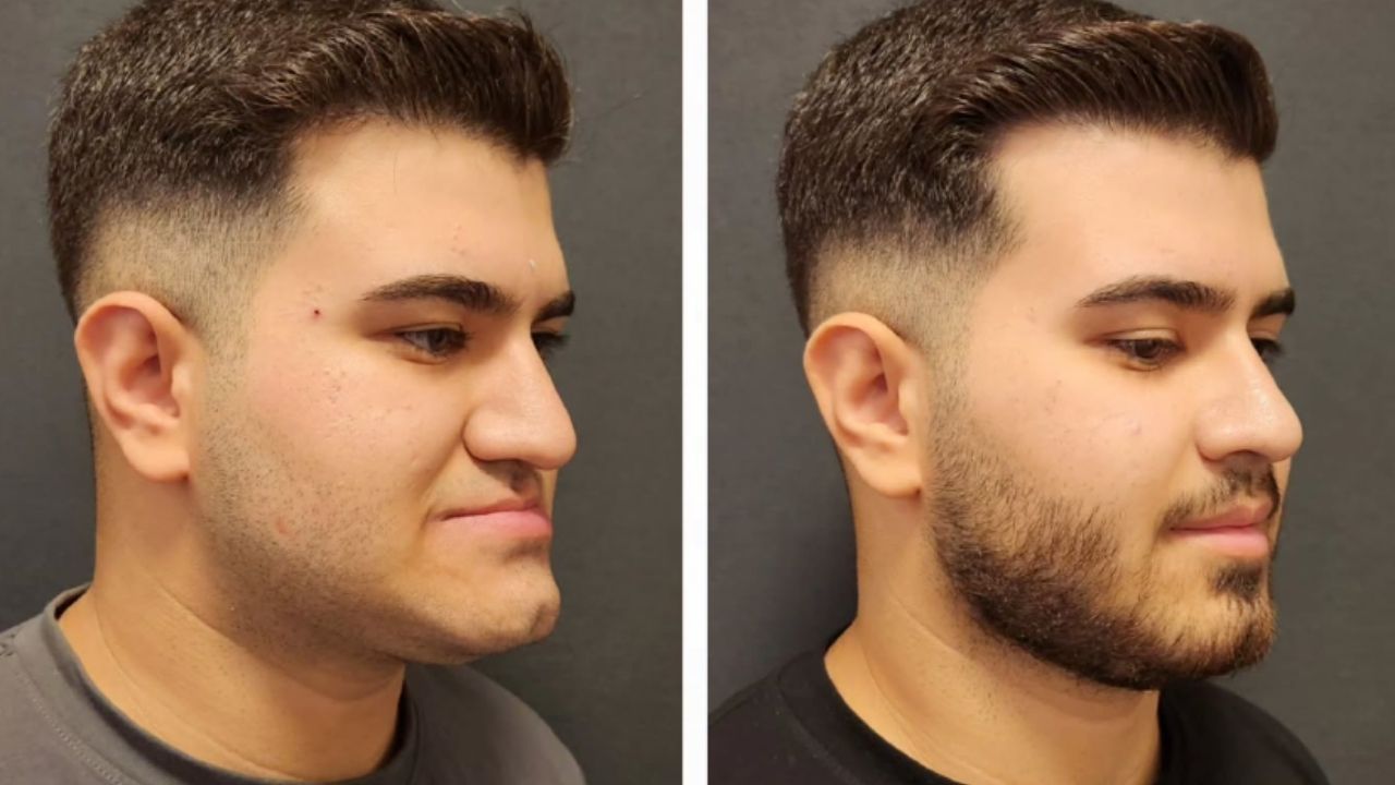 Who Is a Good Candidate for Facial Plastic Surgery?